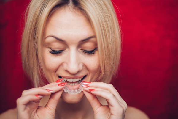 When To Choose Invisalign Over Traditional Braces
