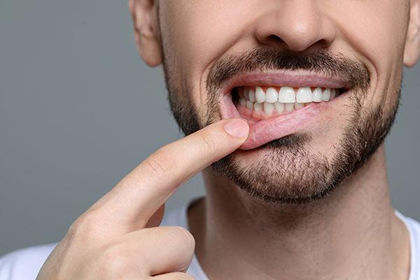 When You Should See A Dentist About Receding Gums